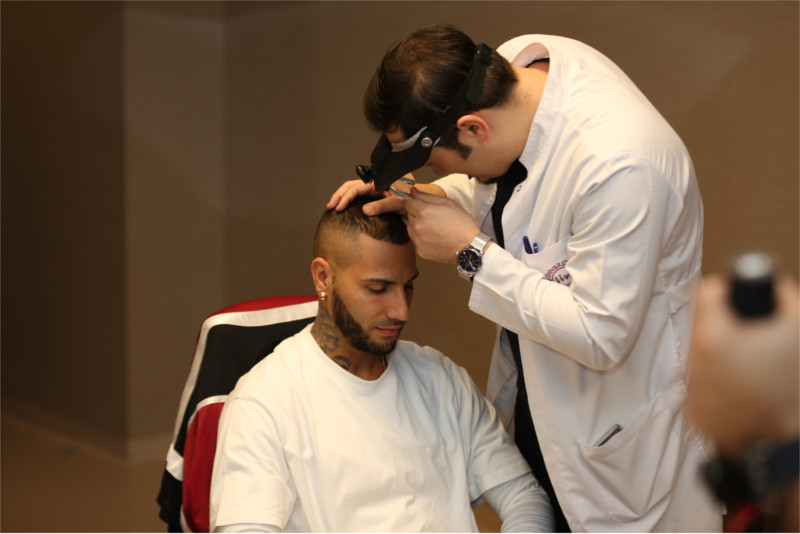 Haarpigmentierung von Ricardo Quaresma bei Elithairtransplant