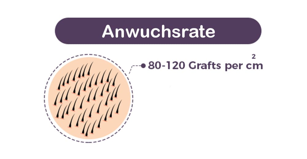 Haartransplantation Schlechte Anwuchsrate