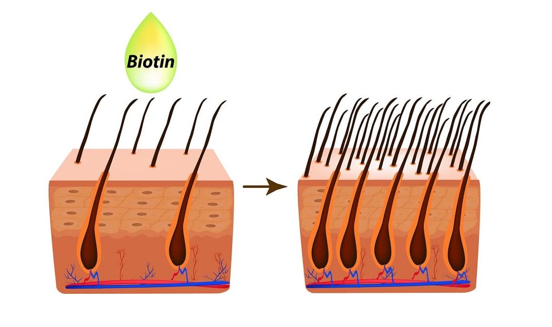 Hilft Biotin gegen Haarausfall?