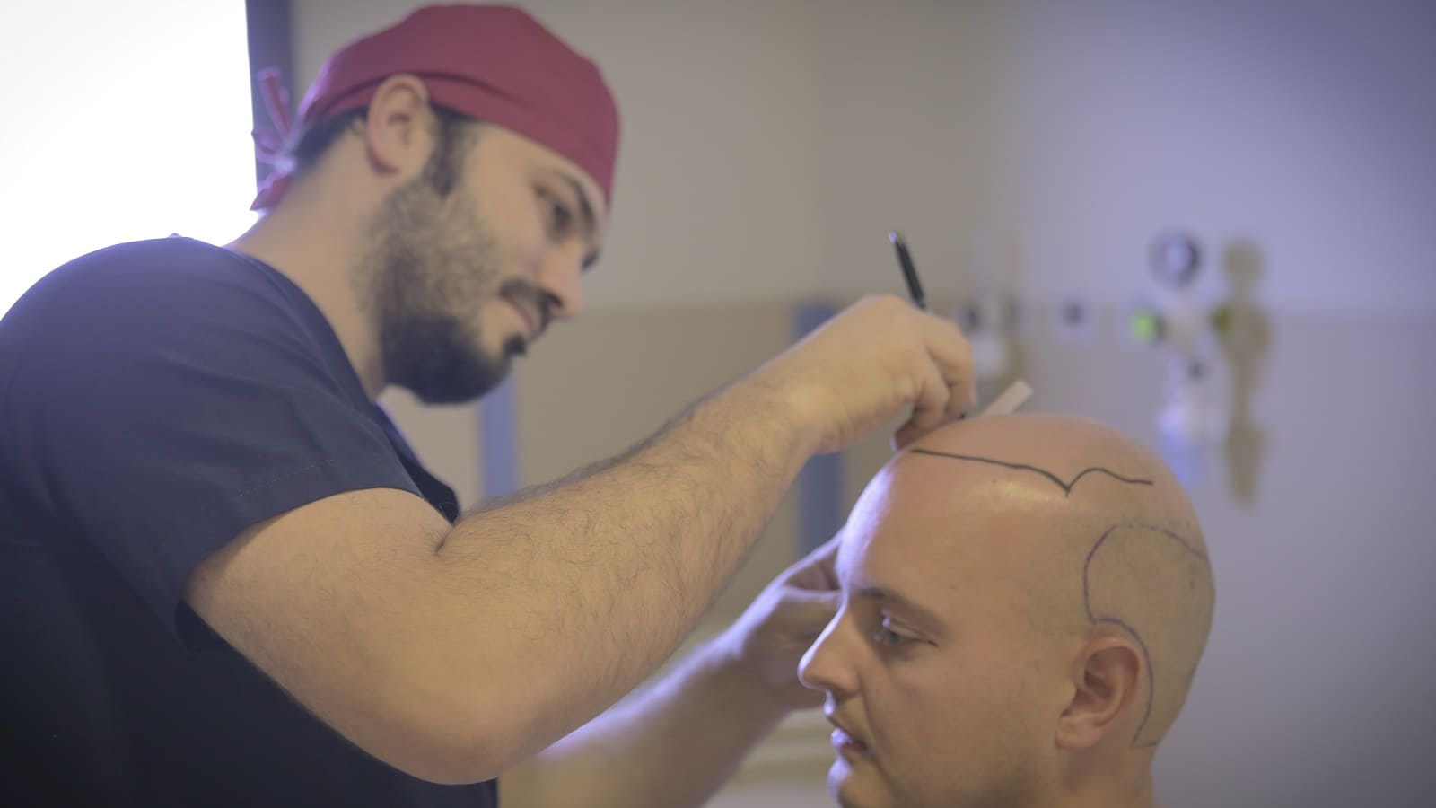 Ist Die Haartransplantation Auch Bei Einer Glatze Moglich