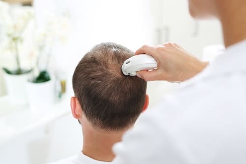 Verschiedene Untersuchungen Darmatologie bei Haarverlust