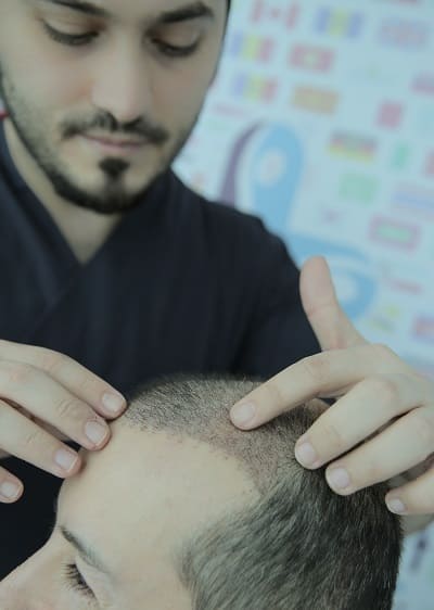 Nach Der Haartransplantation Warum Fallen Die Haare Wieder Aus