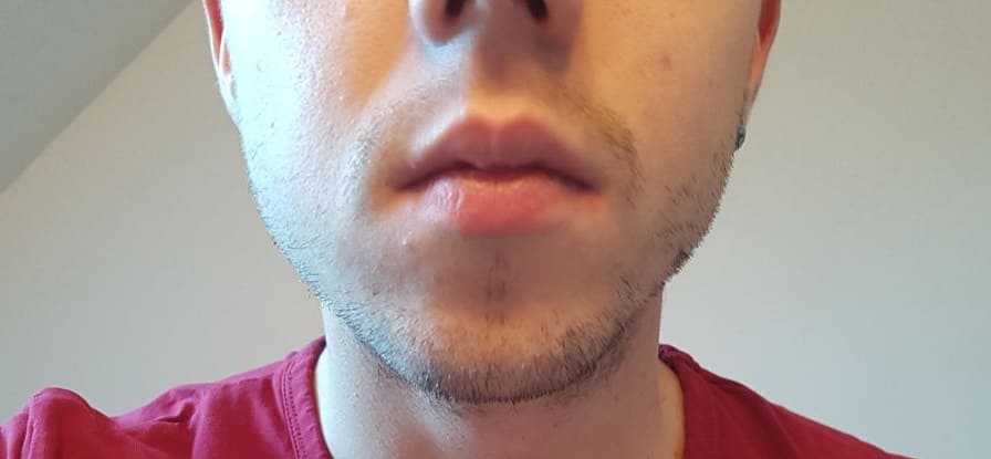 Bartbereich eines jungen Mannes, unterer Gesichtsabschnitt