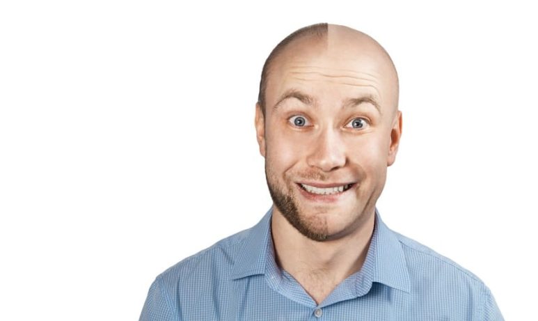 Glatzen Simulator junge Mann mit hlabrasierem Kopf