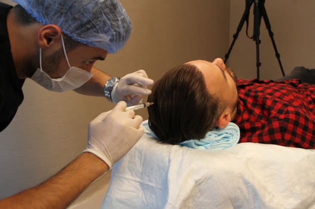 Nach der Haartransplantation PRP Behandlung PRP Behandlung mit der Haartransplantation Elithairtransplant
