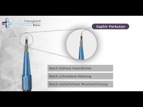 Was Zeichnet Die Fue Saphir Perkutan Haartransplantation So Aus