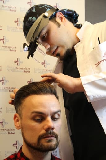 PRP Behandlung nach Haarverpflanzung Nach Haartransplantation schnelle Heilung durch PRP Behandlung