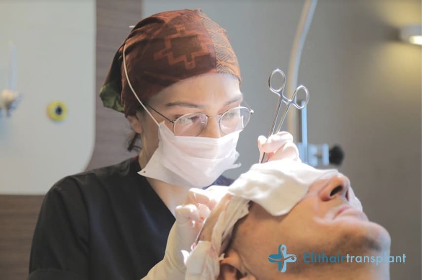 Haartransplantation unter Vollnarkose?