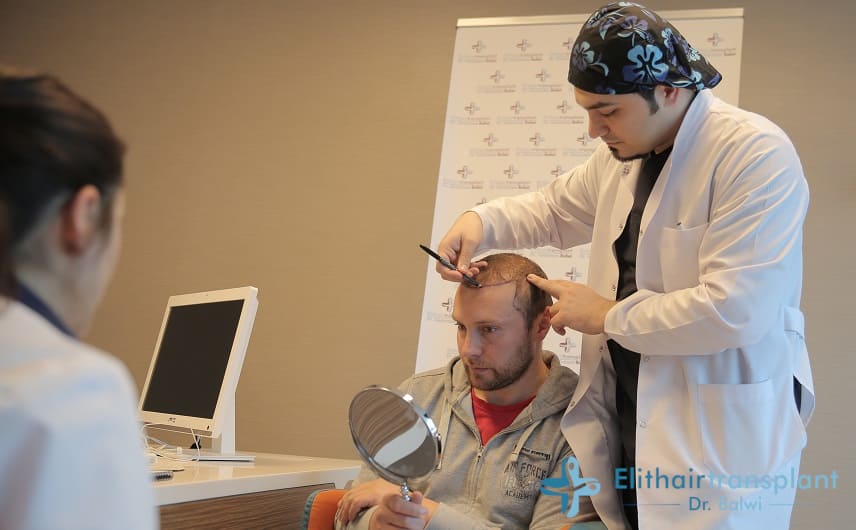 Gründe für eine Haartransplantation - Dr. Balwi zeichtnet die Haarlinie