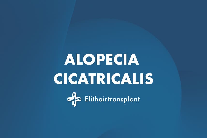 Vernarbender Haarausfall: Alopecia cicatricalis