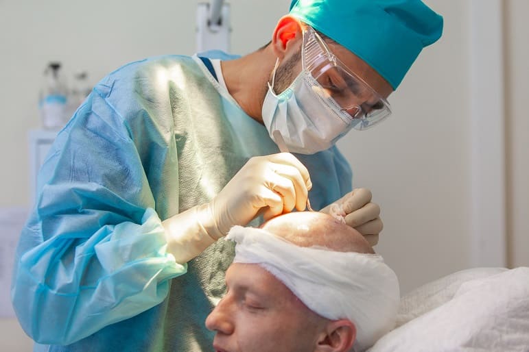 Arzt verpflanzt Haare bei einem Patienten mit Glatze