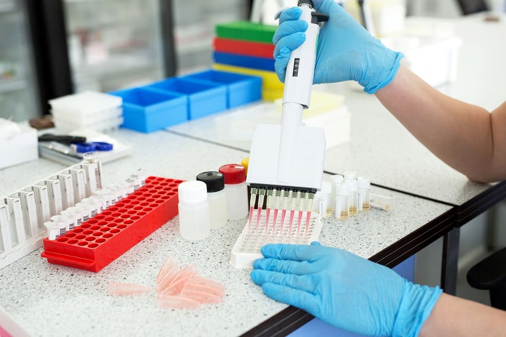 Eine Ursachenforschung sollte stets durchgeführt werden Assistent bereitet die Blutproben im Labor vor