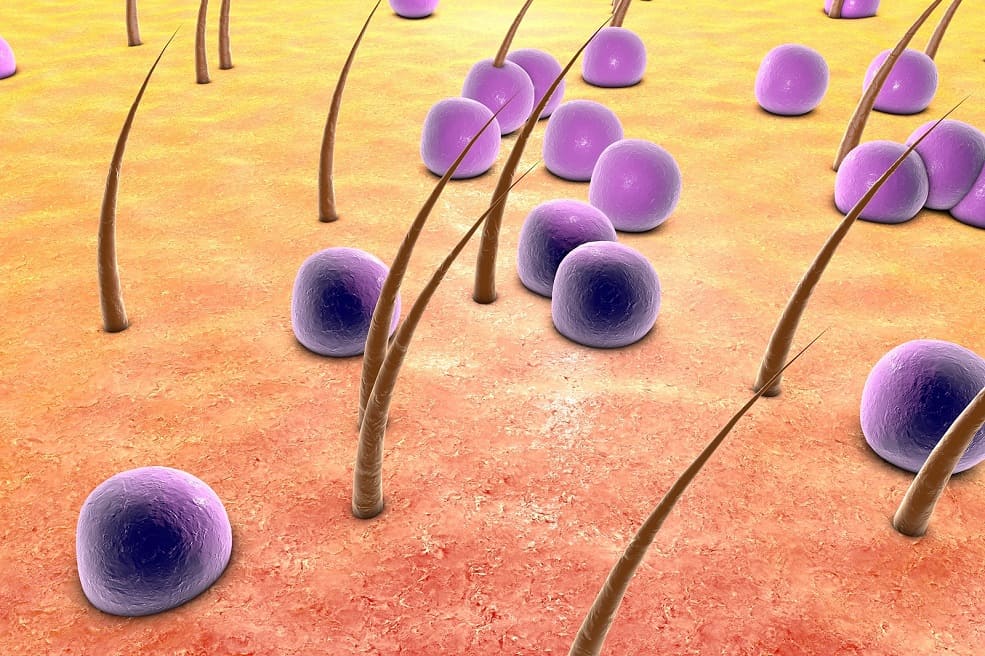 3D-Ansicht von Staphylococcus aureus an den Haaren