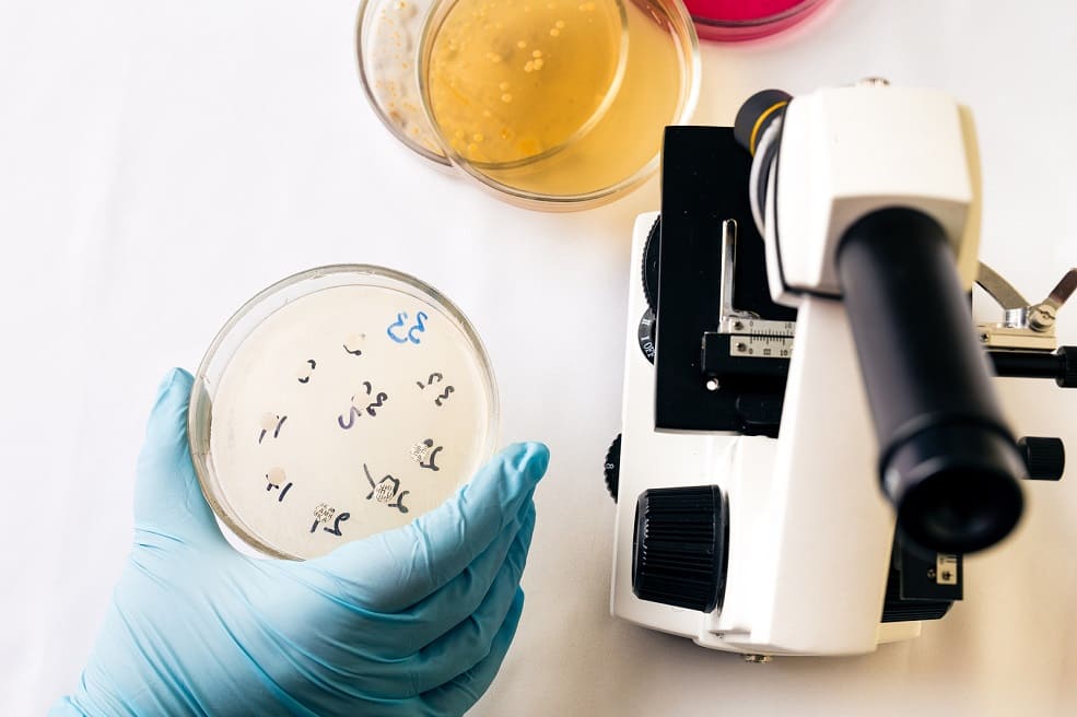 Hand hält Petrischale mit Staphylococcus aureus Bakterien neben einem Mikroskop