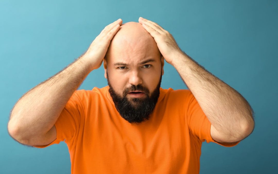 Von Alopecia universalis zur Perücke