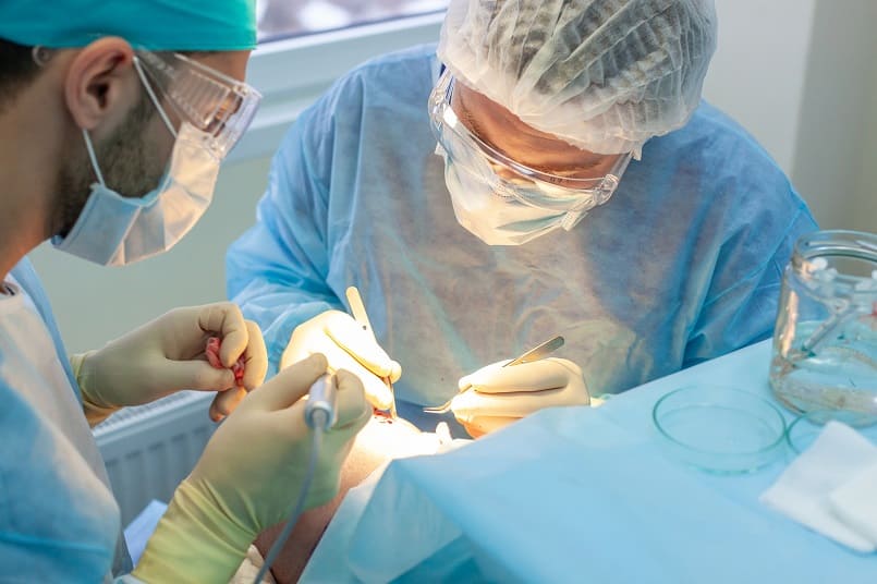 Eine Haartransplantation kann bei Haarausfall Abhilfe schaffen Nahaufnahme einer Haartransplantation