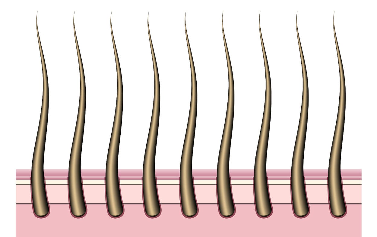 Was Sind Die Kosten Von Bis Zu 5000 Grafts Elithair