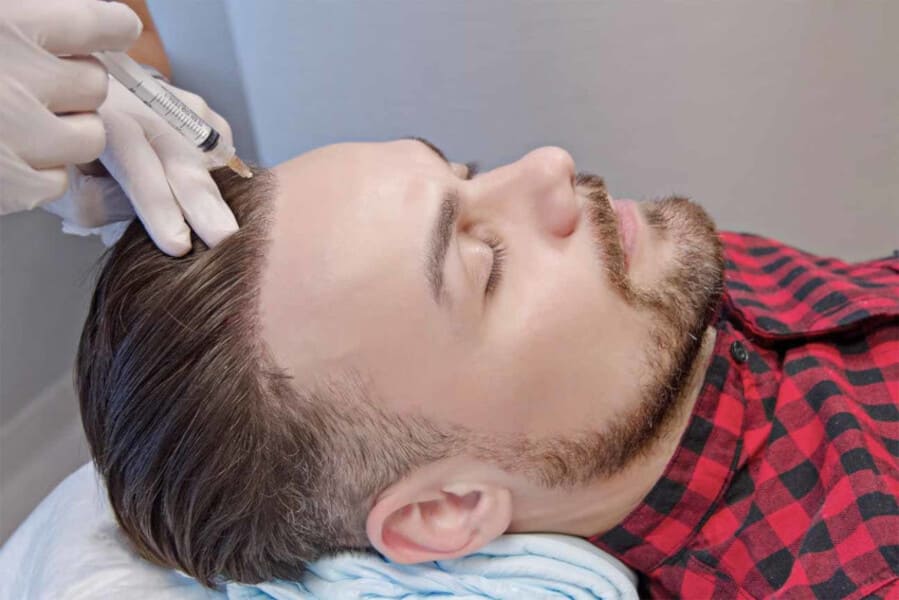 foto di un paziente che riceve un trattamento prp per i capelli