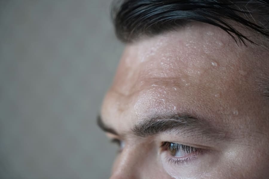 il sudore può causare danni al cuoio capelluto e quindi anche ai capelli