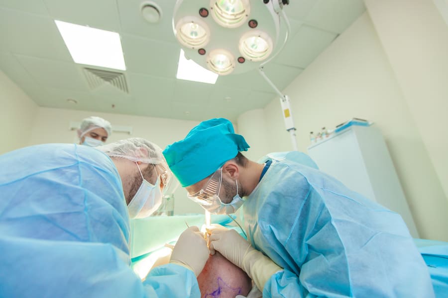 un gruppo di chirurghi mentre esegue un trapianto di capelli