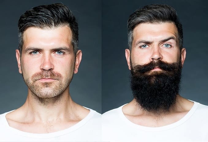 foto che mostra la differenza prima e dopo un trapianto di barba