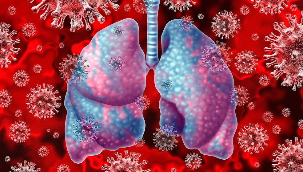 il coronavirus attacca i polmoni