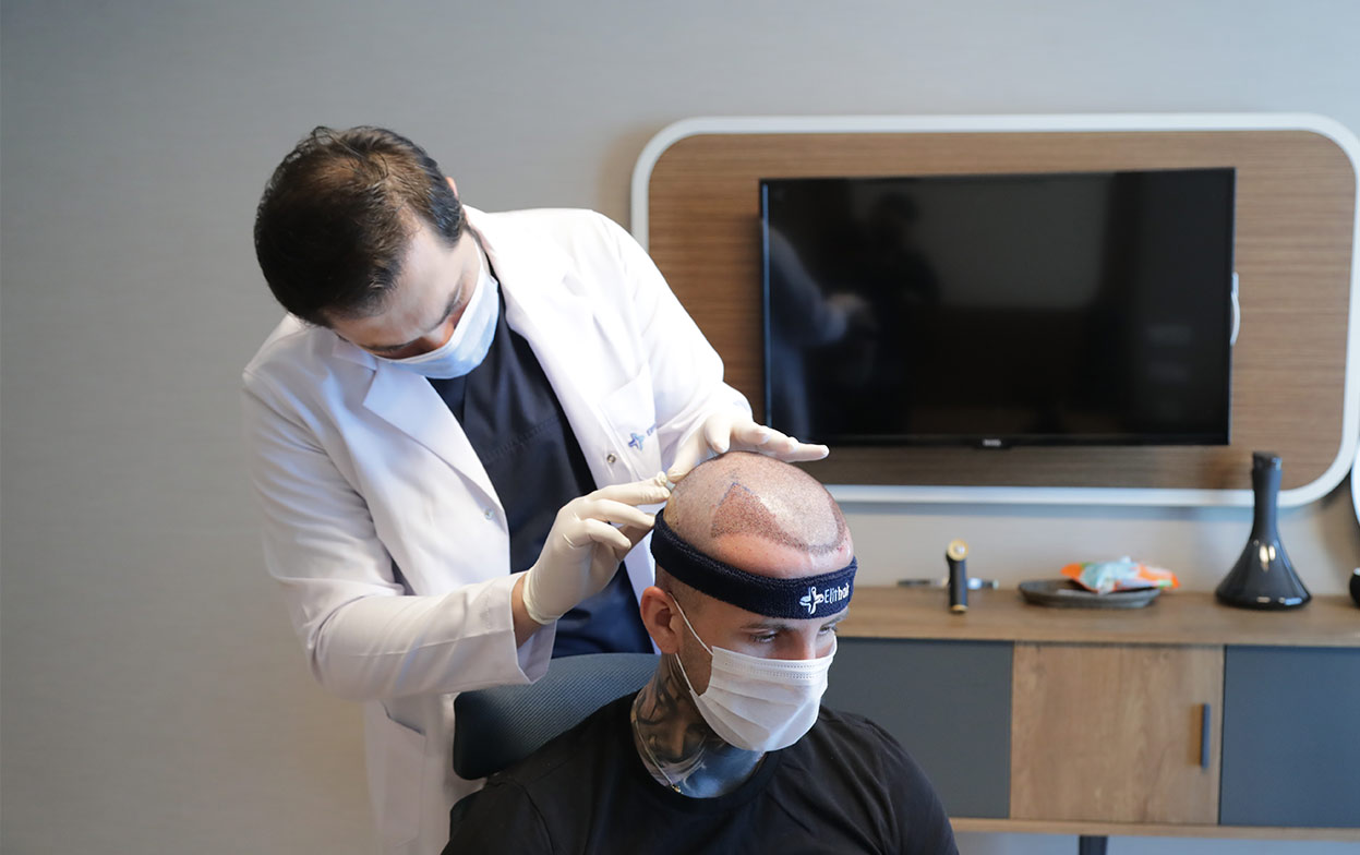 Il Dr. Balwi controlla come procede la fase post operatoria del trapianto di capelli di un paziente di Elithair