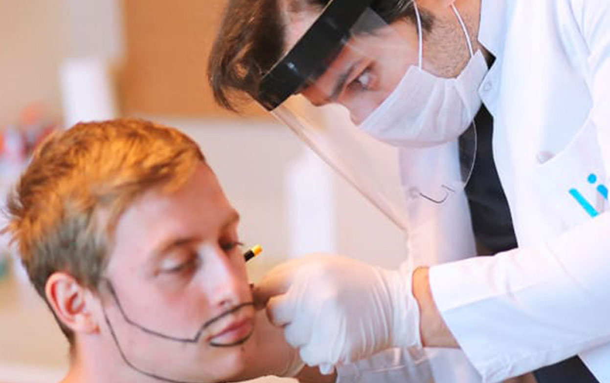 Il Dr. Balwi disegna la nuova attaccatura della barba in un paziente prima del trapianto di barba presso Elithair
