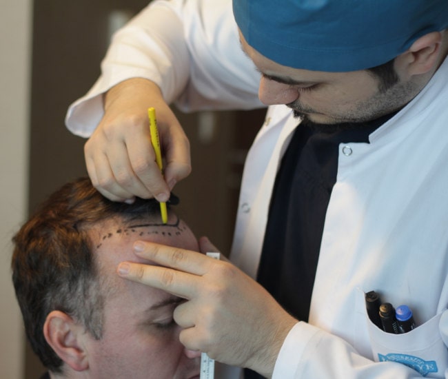 Il dr Balwi disegna una linea sottile di un paziente che sarà la nuova attaccatura dei capelli