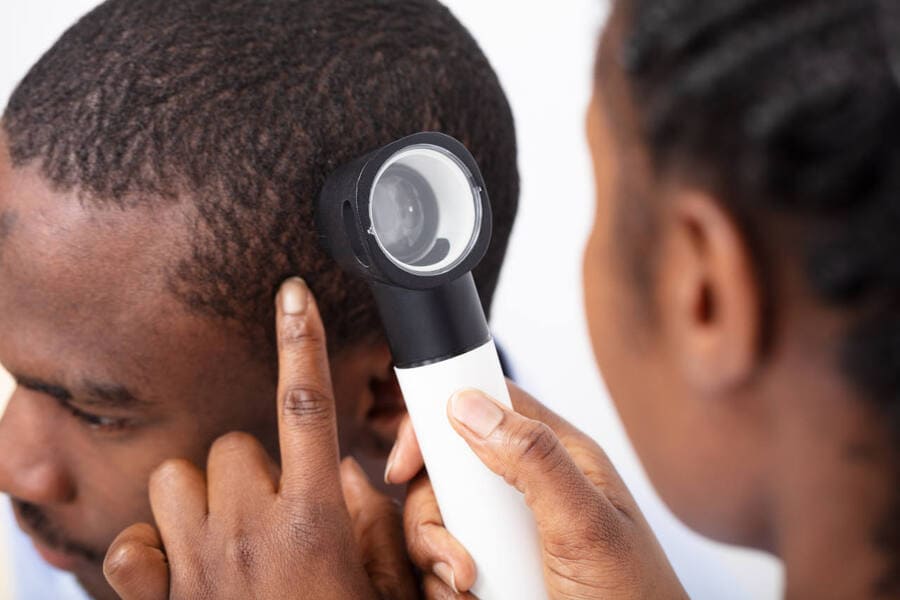 un paziente effettua un'analisi tricologica prima di un trapianto di capelli afro