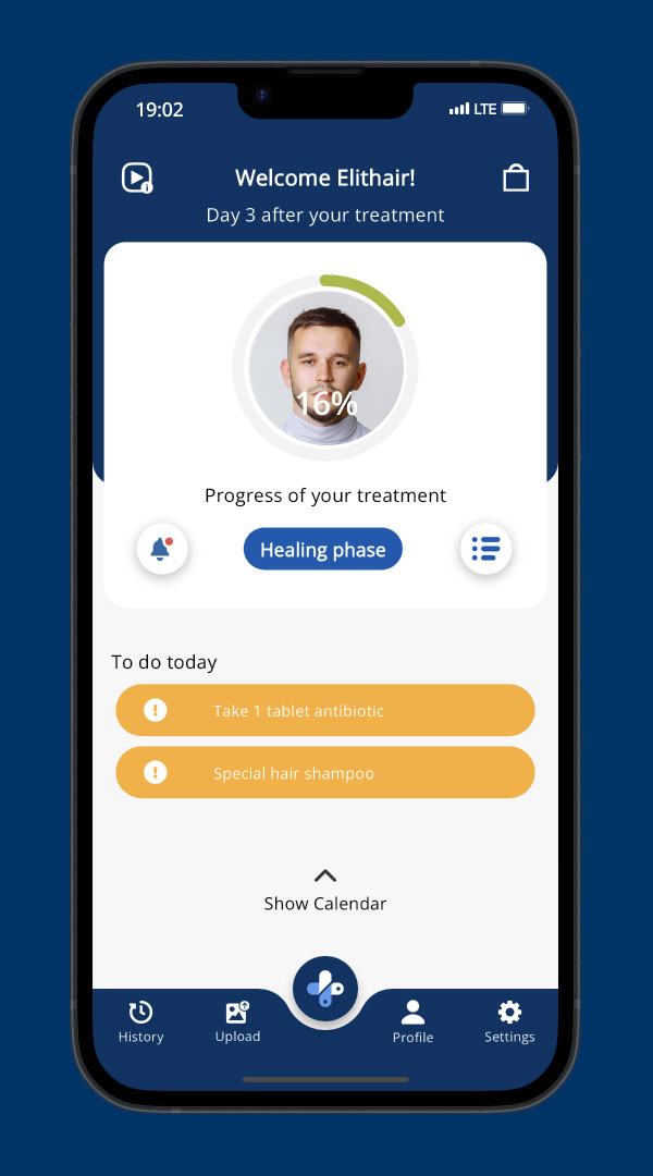 elithair-app-calendário-de -seguimento-do-tratamento-personalizado