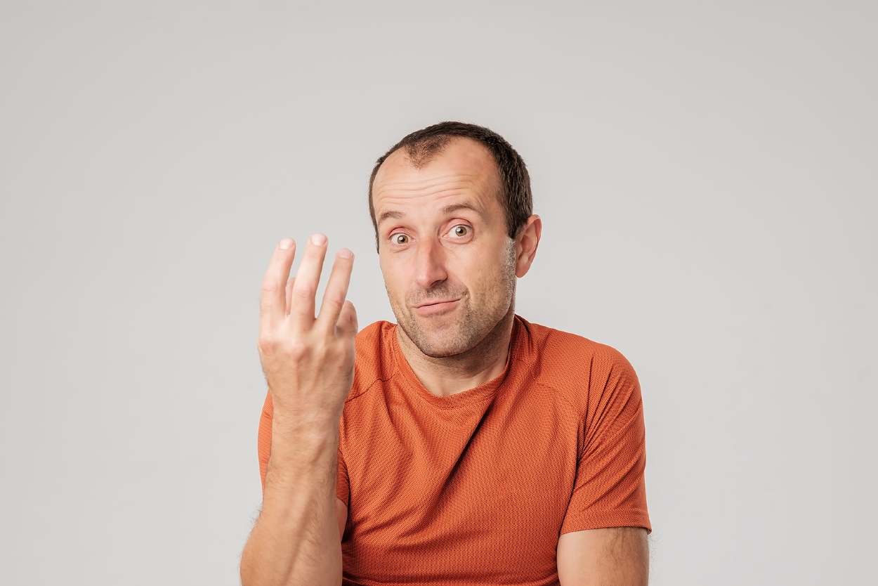 Hombre con alopecia androgenética y tres dedos alzados