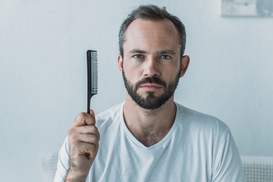 Hombre con un peine en la mano mostrando los efectos de la alopecia en hombres