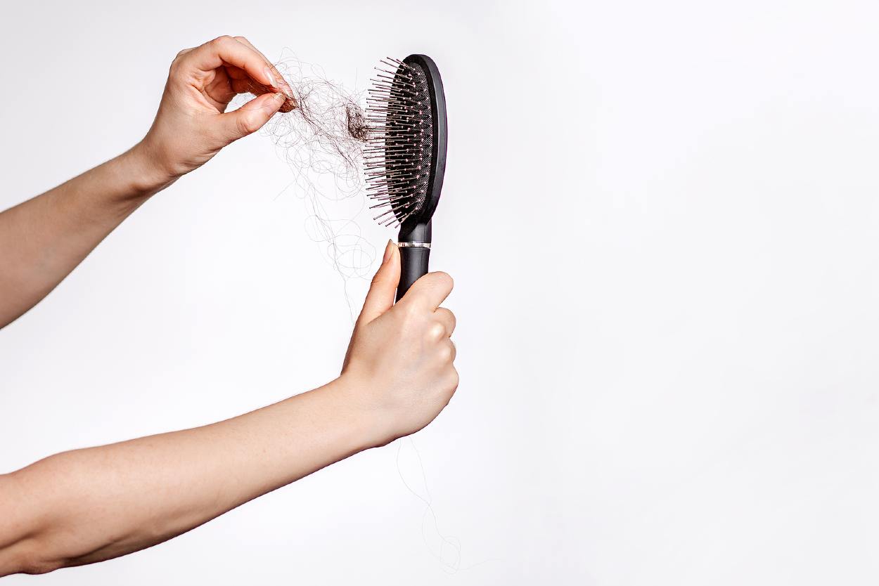 Mujer sujetando cepillo con caída del pelo excesiva