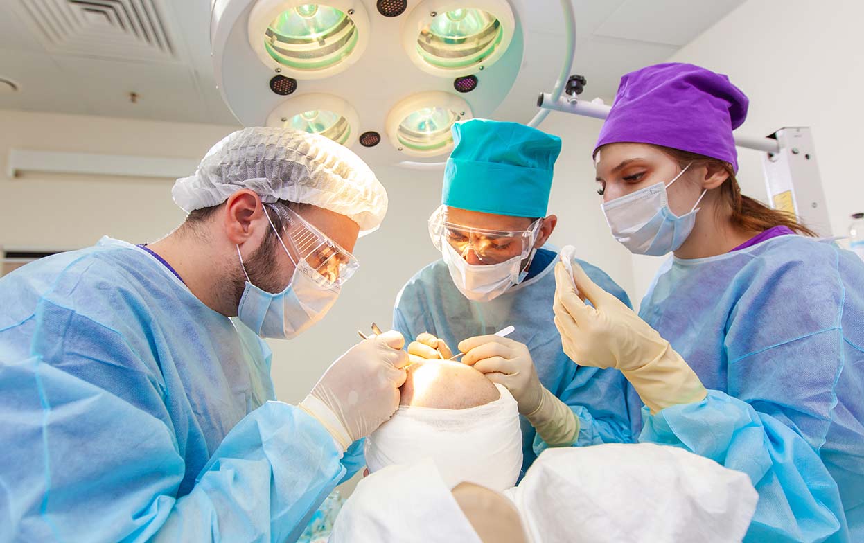 Equipo médico en el quirófano durante la operación de trasplante capilar percutáneo