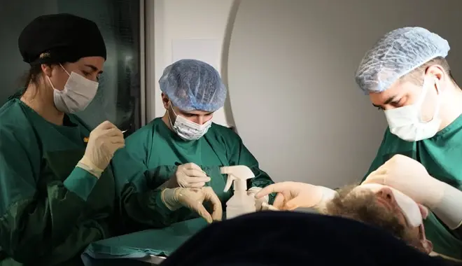 Imagen que muestra al equipo médico de Elithair preparando los injertos para su inserción en la zona donante de un paciente.