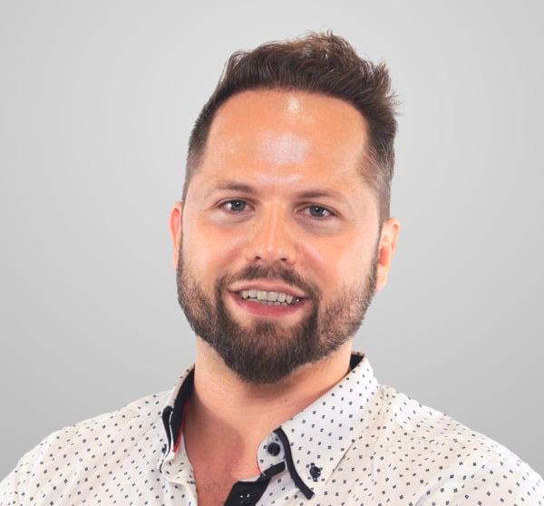 Man with thick hair after a hair transplant