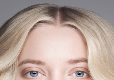 Woman with a thick hairline after a successful hair transplant for women