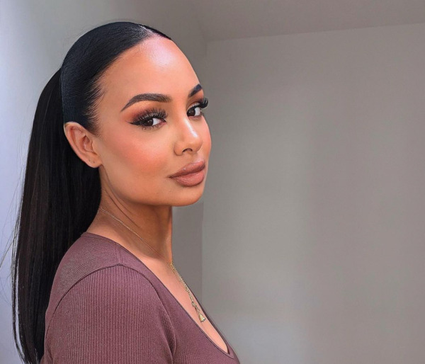 Woman with her hair tied back after a hair transplant
