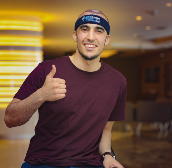 Young man in post-hair transplant healing phase gives thumbs up