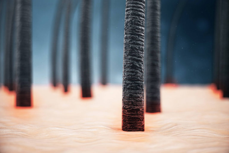 Learn About Hair Loss Care With Our Hair Transplant Blog Elithair