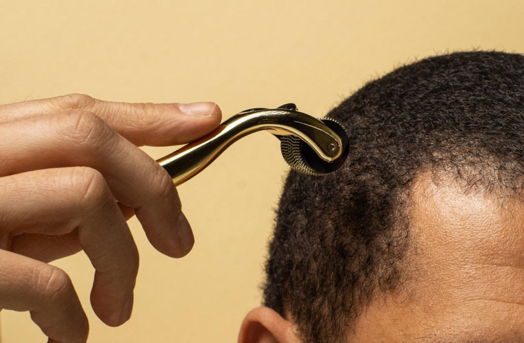 Learn About Hair Loss Care With Our Hair Transplant Blog Elithair